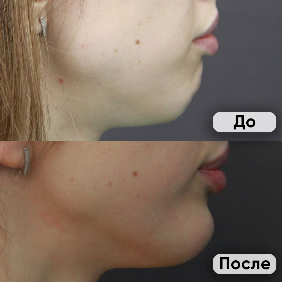 До